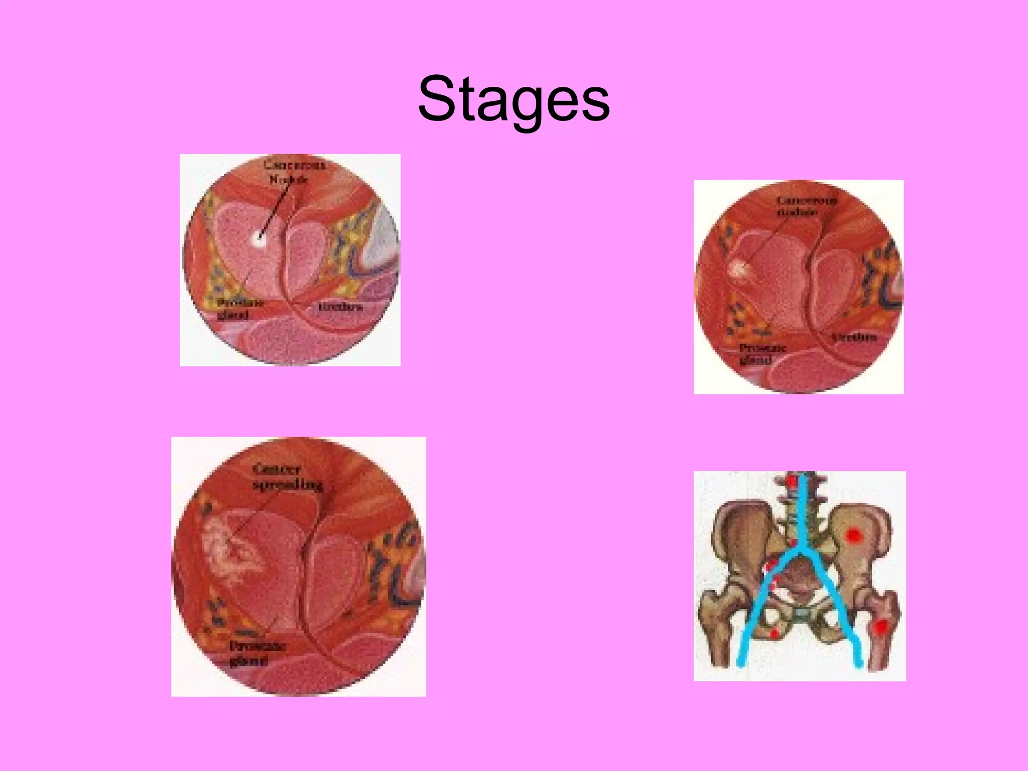 Reproductive systemdisorders