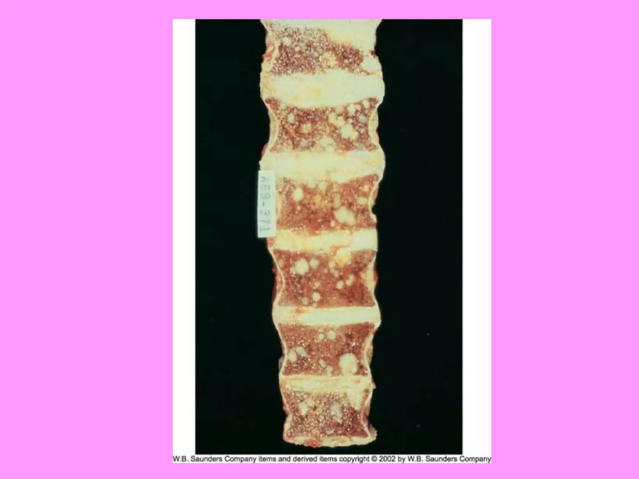 Reproductive systemdisorders