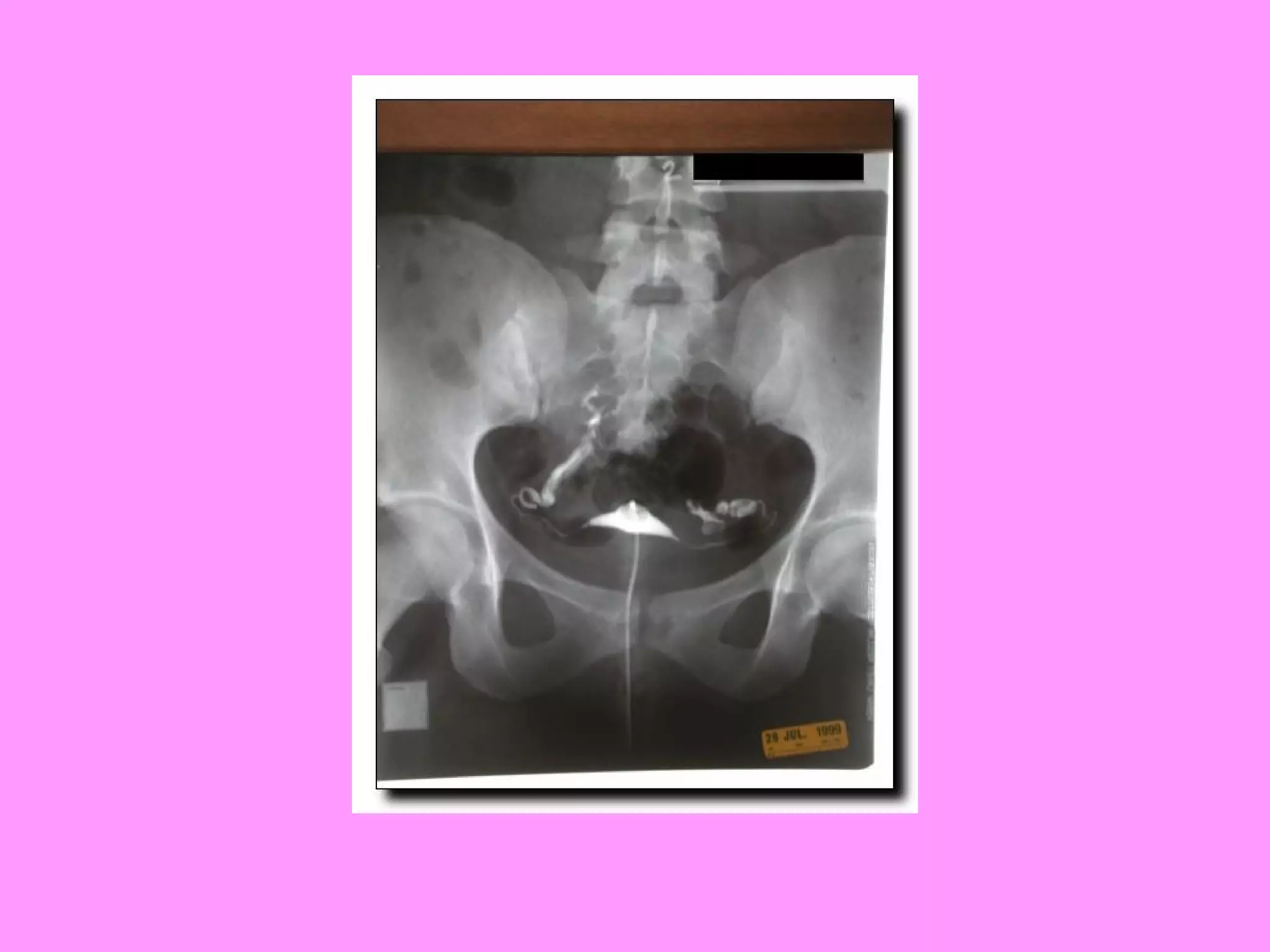 Reproductive systemdisorders