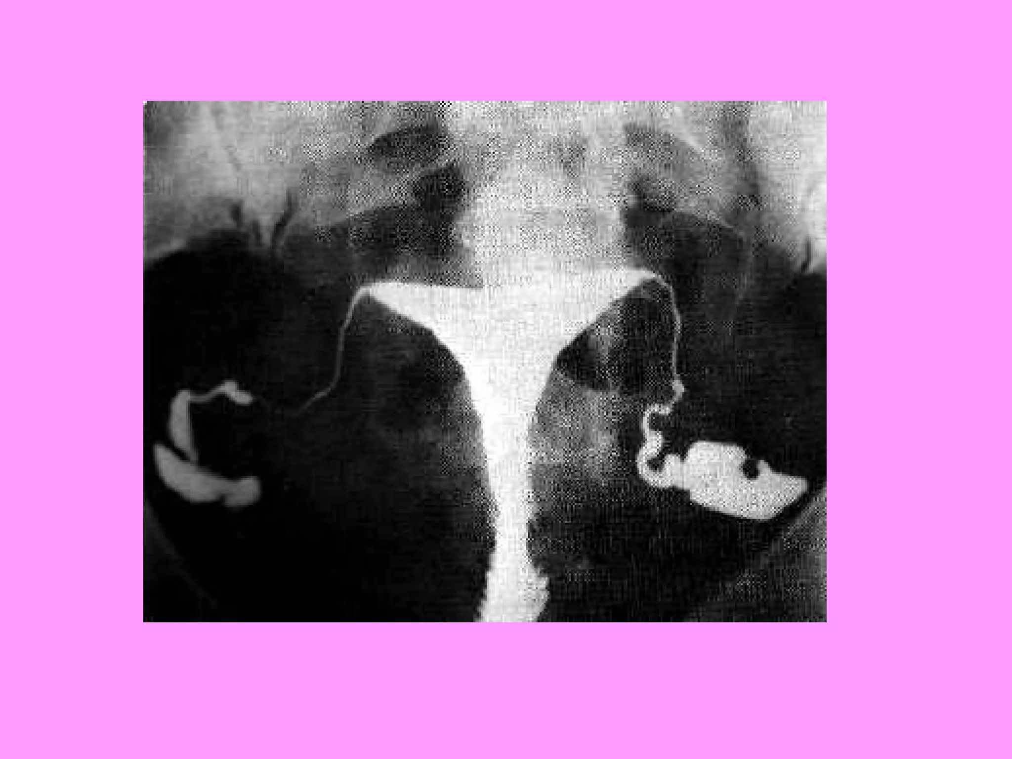 Reproductive systemdisorders