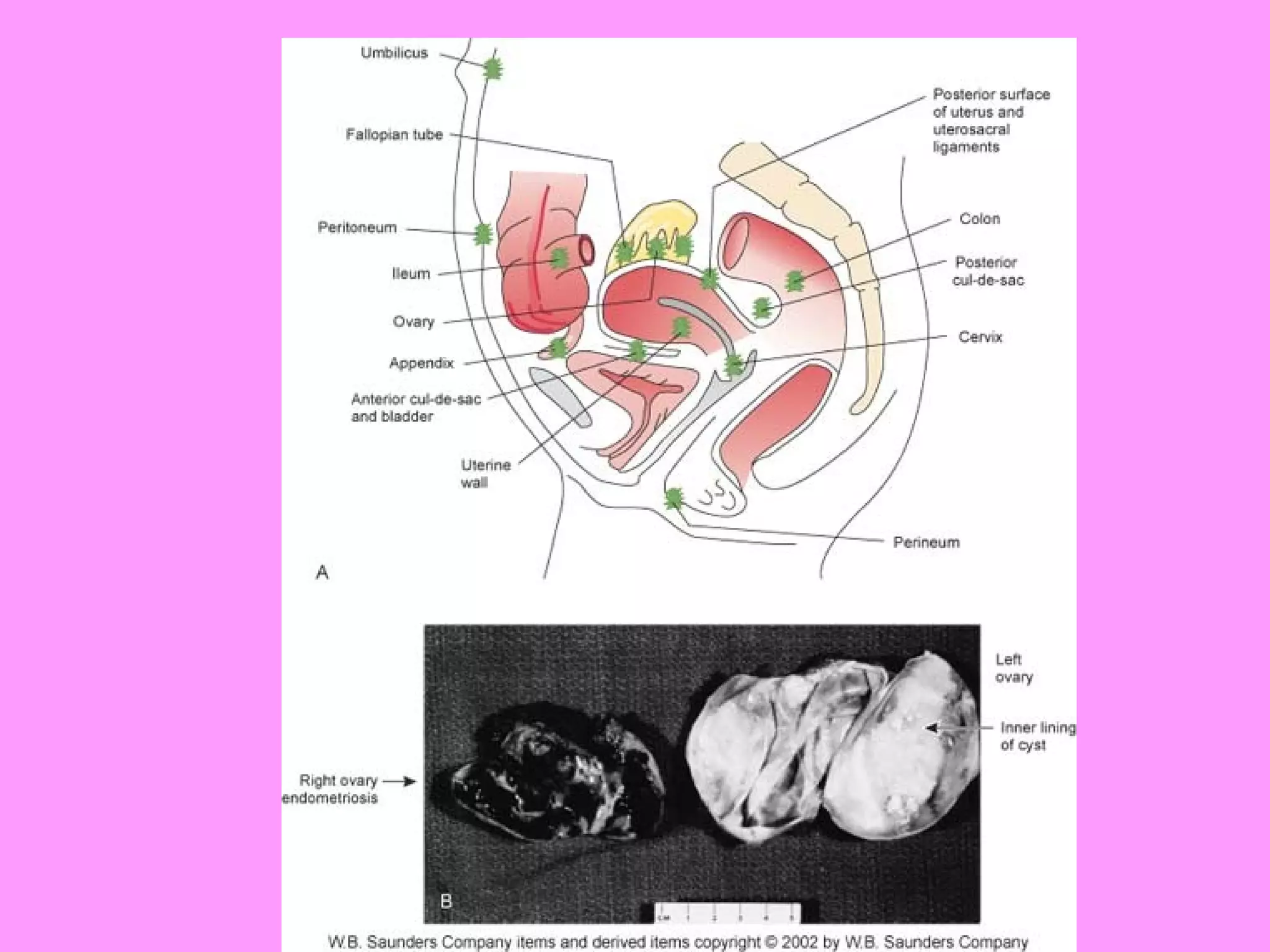 Reproductive systemdisorders