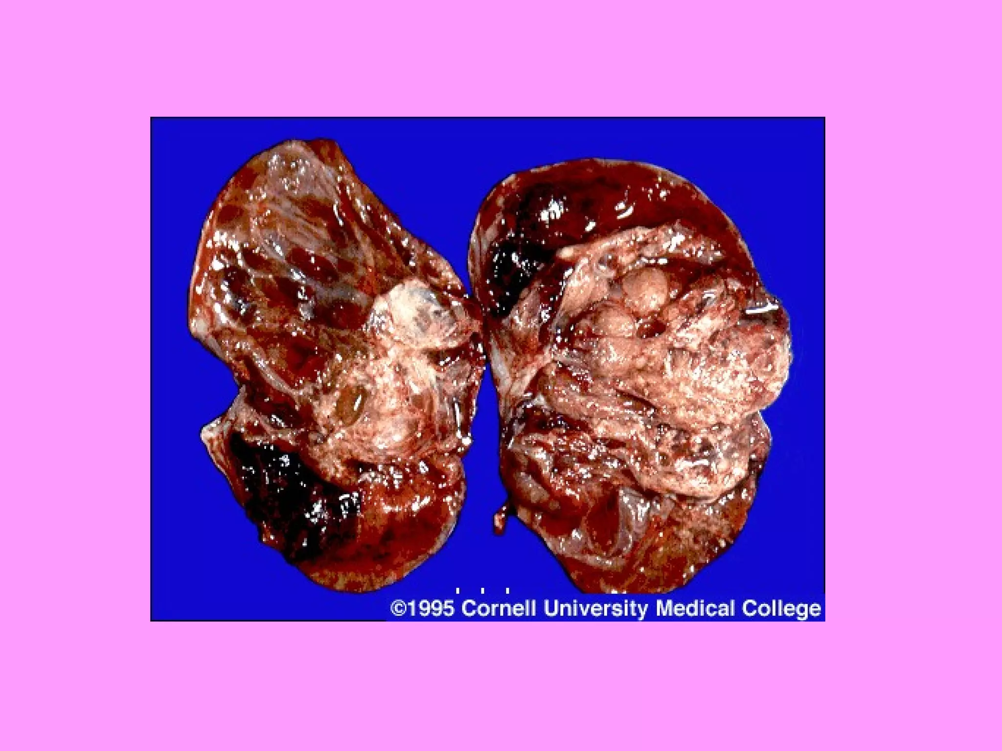 Reproductive systemdisorders