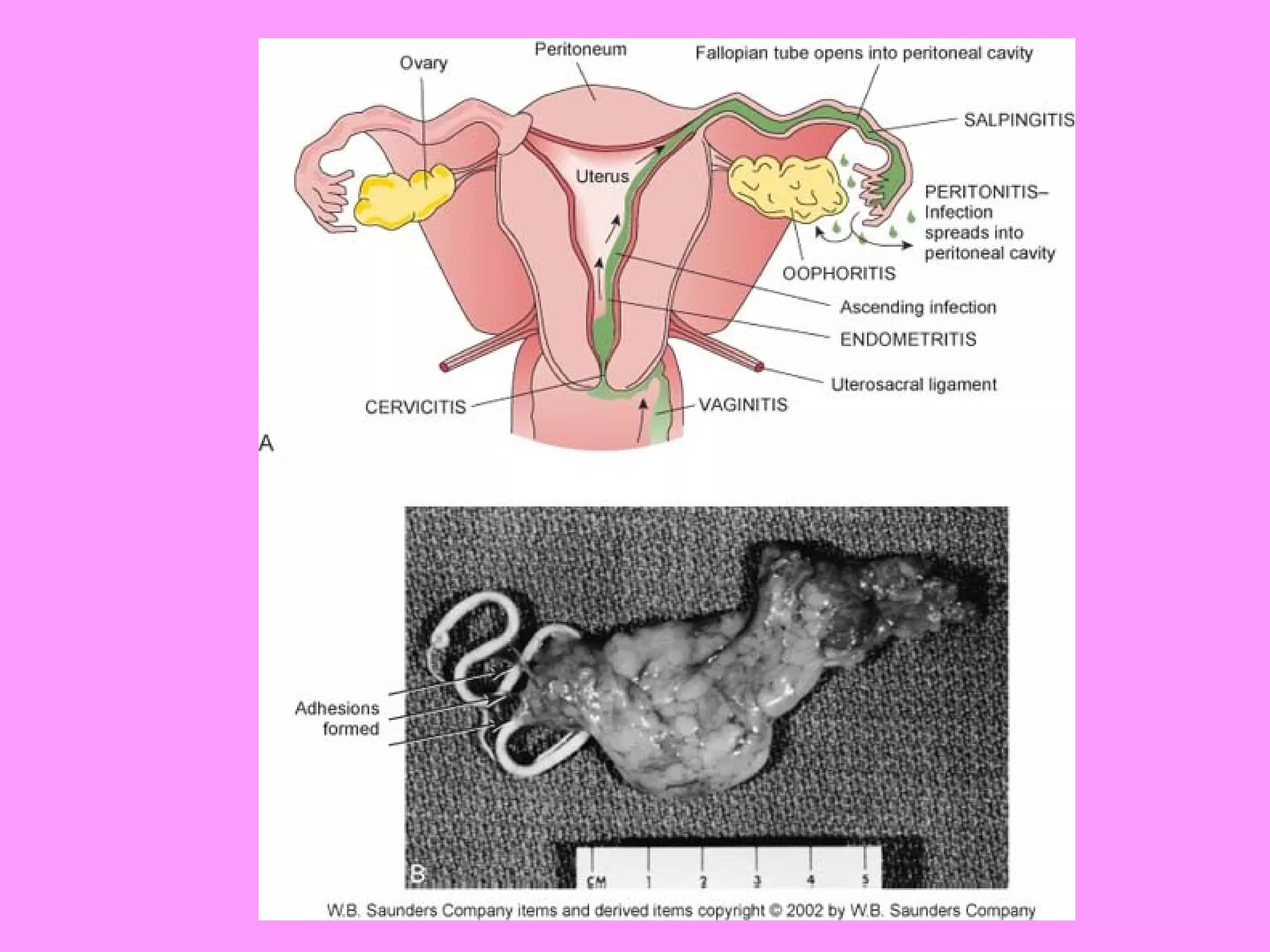 Reproductive systemdisorders