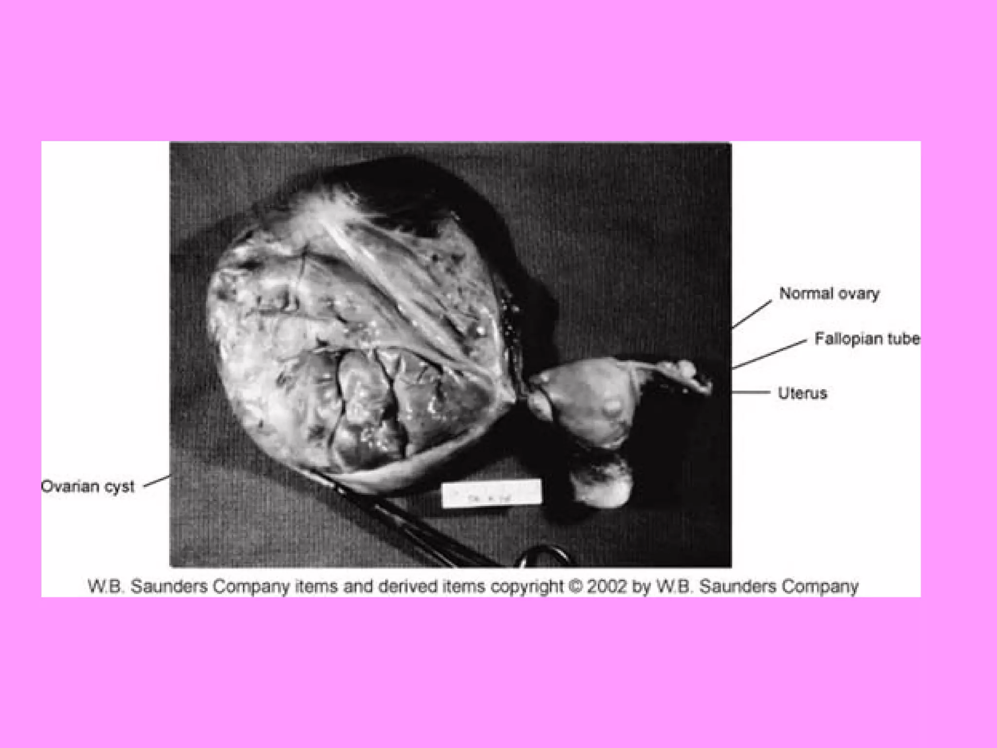 Reproductive systemdisorders