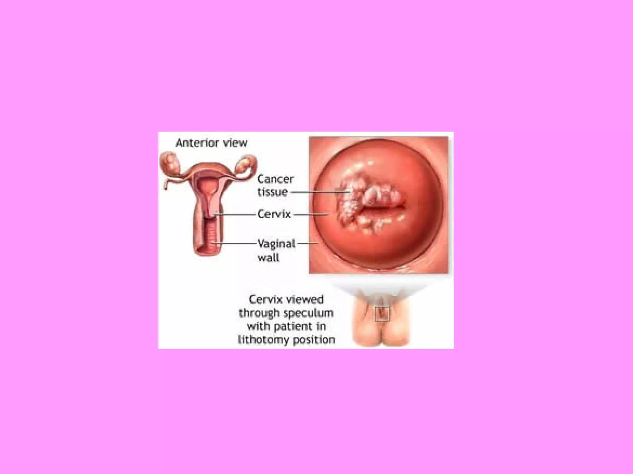 Reproductive systemdisorders