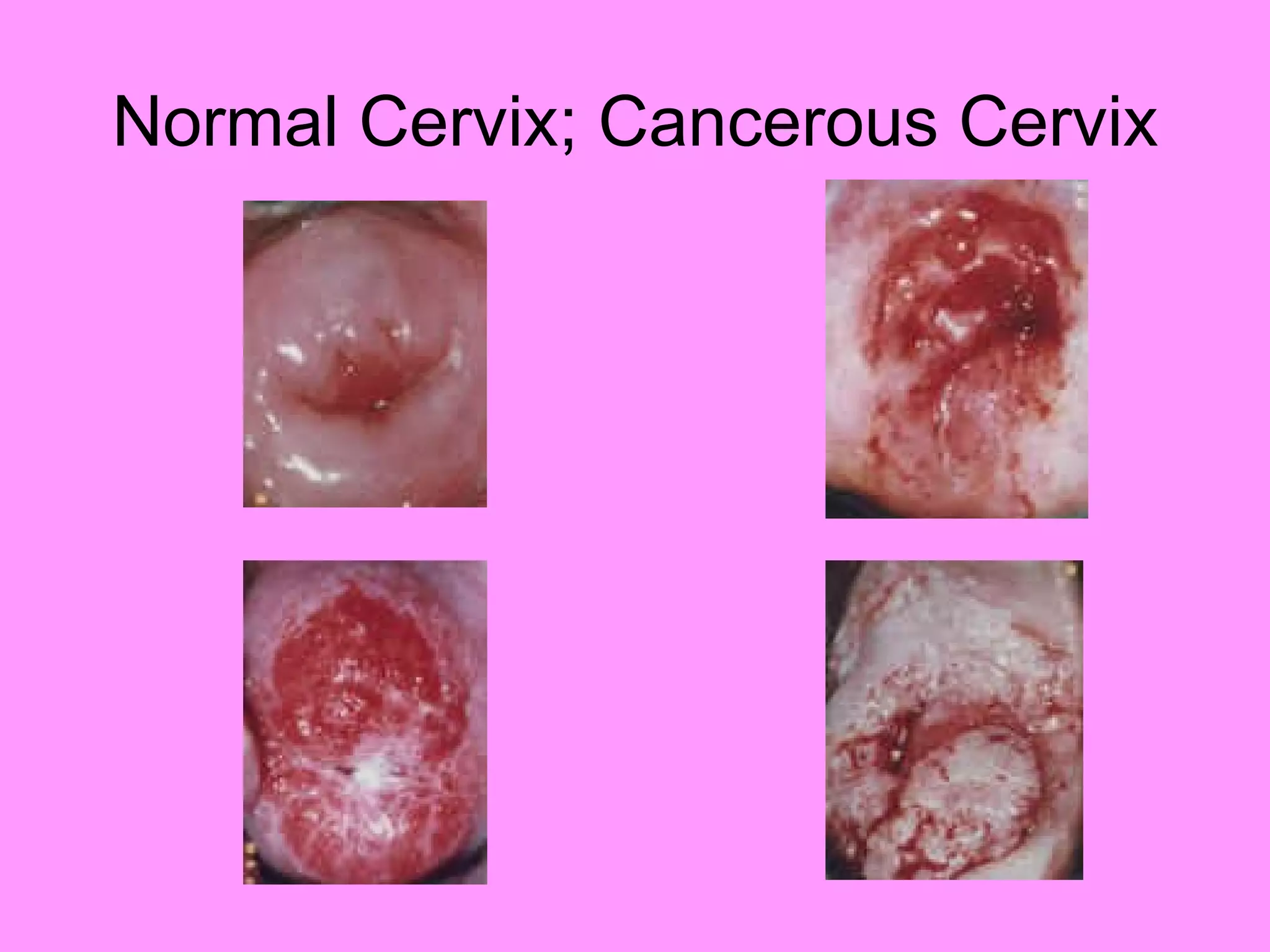 Reproductive systemdisorders