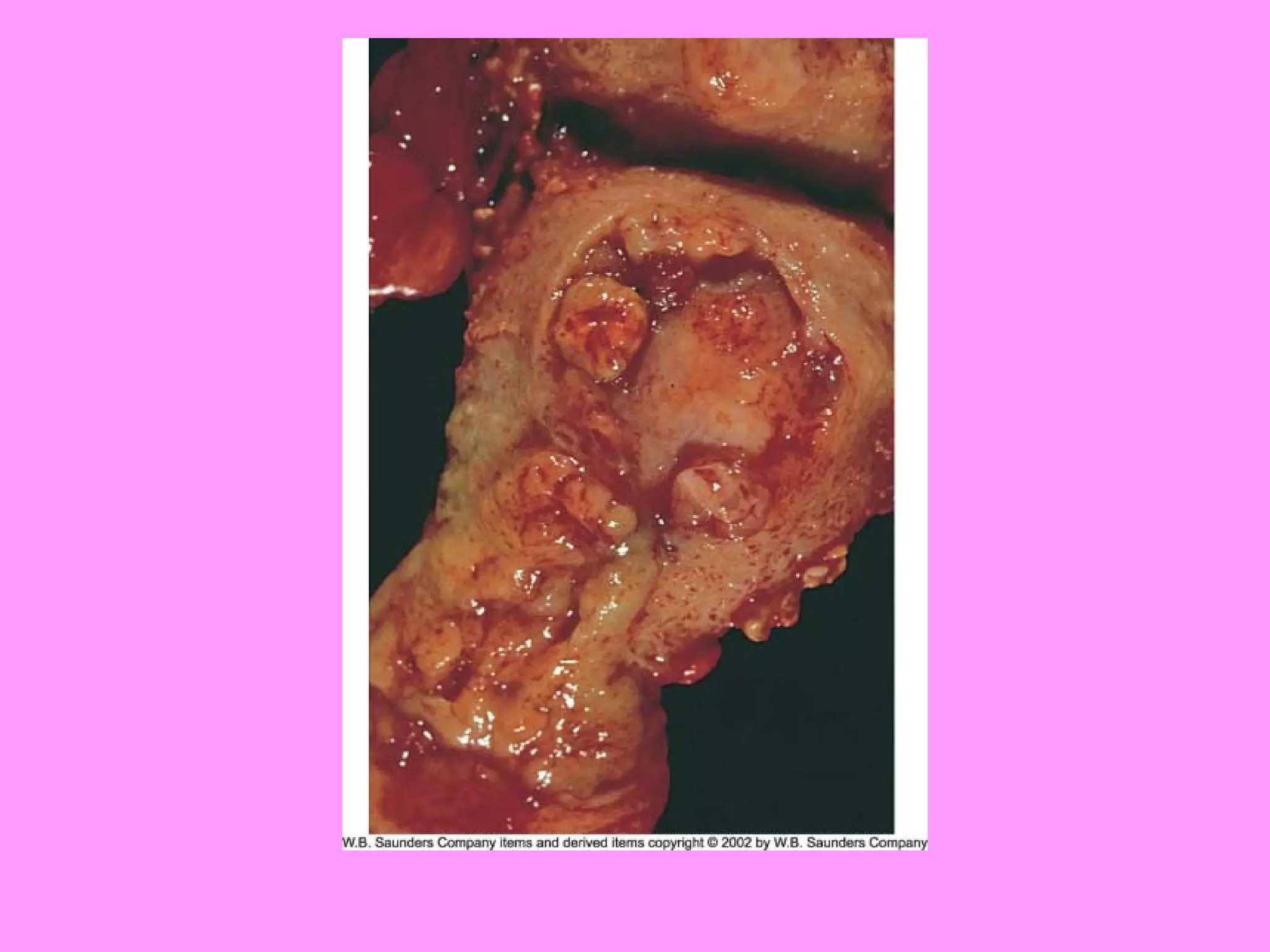 Reproductive systemdisorders