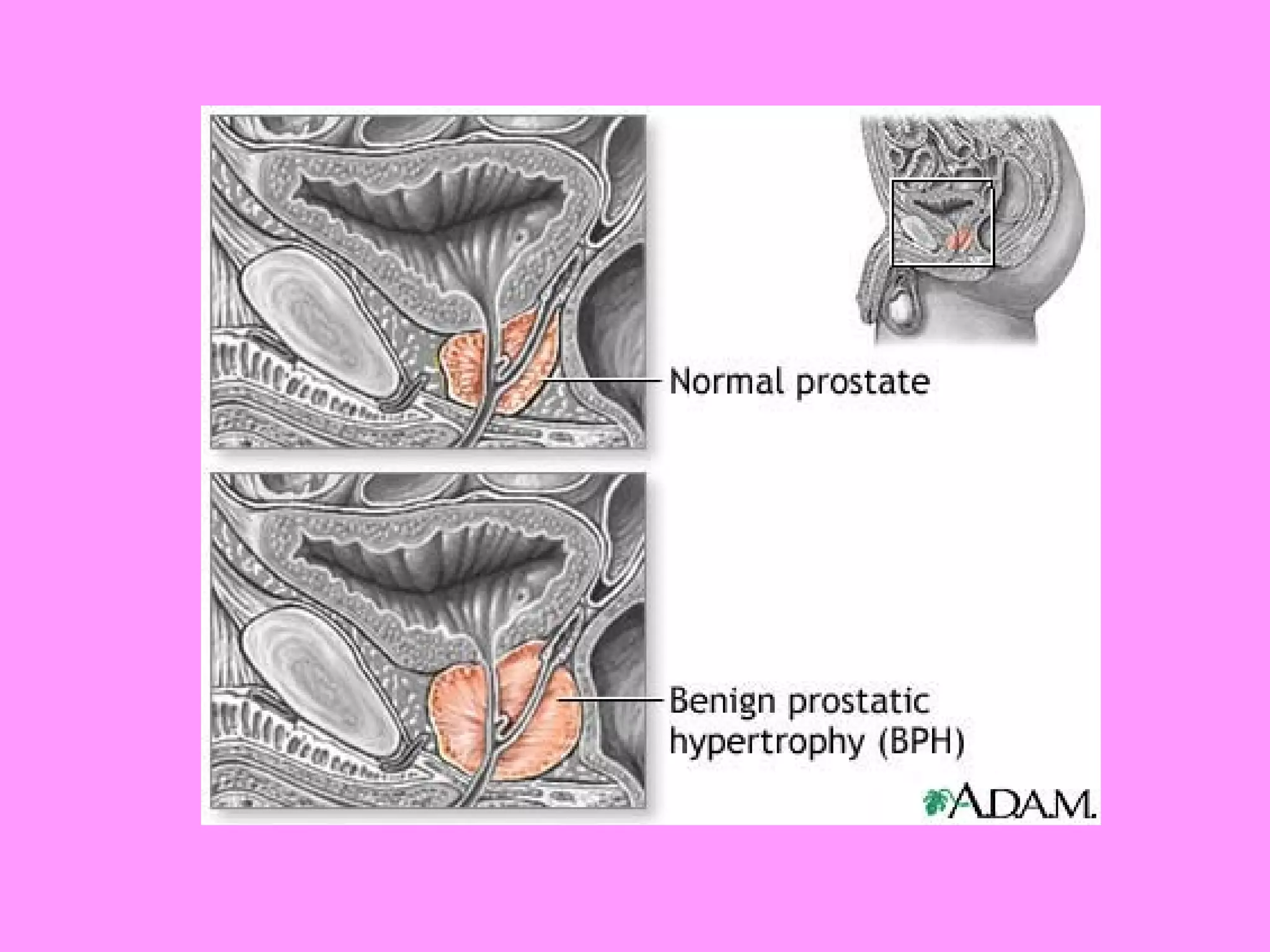Reproductive systemdisorders