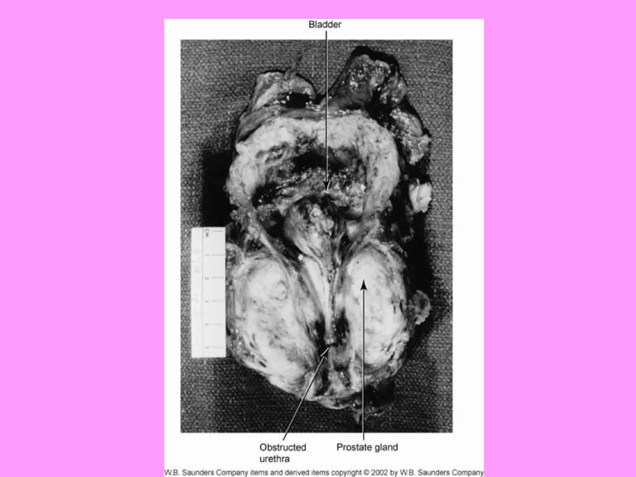 Reproductive systemdisorders