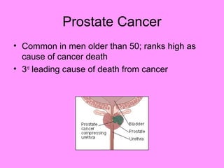Prostate Cancer
• Common in men older than 50; ranks high as
cause of cancer death
• 3rd
leading cause of death from cancer
 