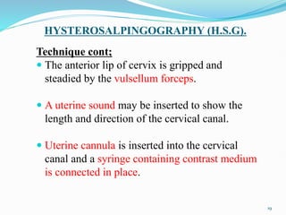 HYSTEROSALPINGOGRAPHY (H.S.G).
Technique cont;
 The anterior lip of cervix is gripped and
steadied by the vulsellum forceps.
 A uterine sound may be inserted to show the
length and direction of the cervical canal.
 Uterine cannula is inserted into the cervical
canal and a syringe containing contrast medium
is connected in place.
19
 