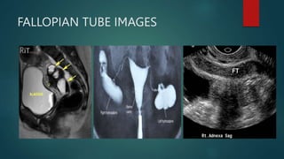 REPRODUCTIVE SYSTEM PPT.pptx radiographic | PPTX
