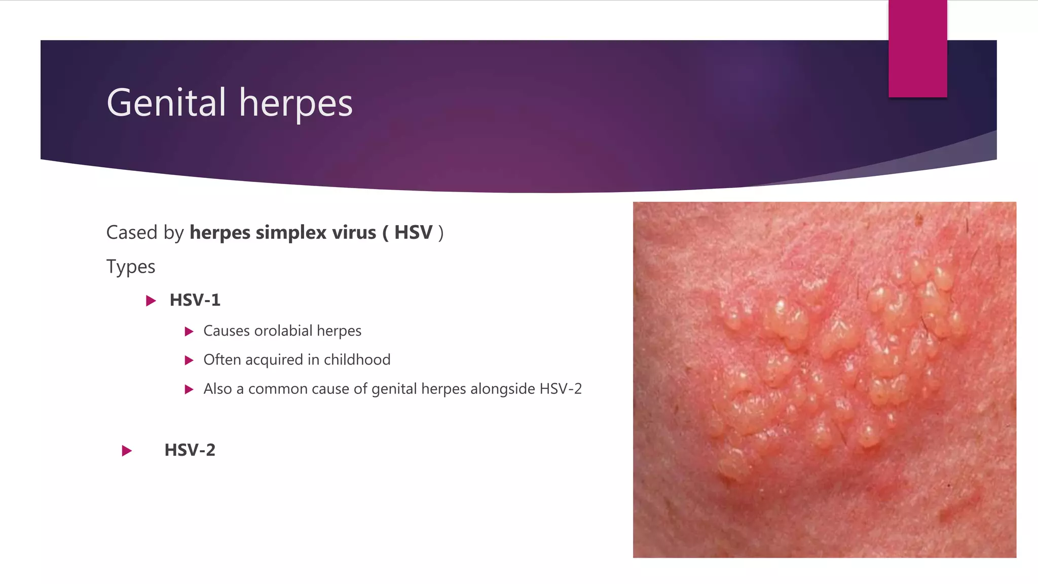 reproductive tract infections.pptx