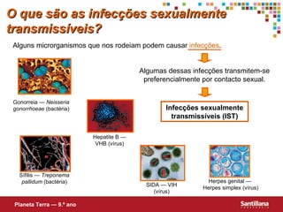 O que são as infecções sexualmente transmissíveis? Alguns microrganismos que nos rodeiam podem causar  infecções . Algumas dessas infecções transmitem-se preferencialmente por contacto sexual. Infecções sexualmente transmissíveis (IST) Planeta Terra — 9.º ano Sífilis  — Treponema pallidum  (bactéria) SIDA — VIH (vírus) Hepatite B — VHB (v írus ) Herpes genital —  Herpes simplex   (vírus) Gonorreia —  Neisseria gonorrhoeae  (bact éria ) 