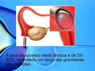 A taxa de sucesso desta técnica é de 25-30%, no entanto um terço das gravidezes são múltiplas. 