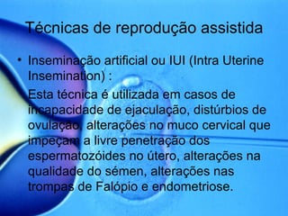 Técnicas de reprodução assistida Inseminação artificial ou IUI (Intra Uterine Insemination) : Esta técnica é utilizada em casos de incapacidade de ejaculação, distúrbios de ovulação, alterações no muco cervical que impeçam a livre penetração dos espermatozóides no útero, alterações na qualidade do sémen, alterações nas trompas de Falópio e endometriose. 