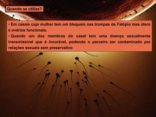 Quando se utiliza? 
• Em casais cujo mulher tem um bloqueio nas trompas de Falópio mas útero 
e ovários funcionais. 
• Quando um dos membros do casal tem uma doença sexualmente 
transmissível que é incurável, podendo o parceiro ser contaminado por 
relações sexuais sem preservativo 
 