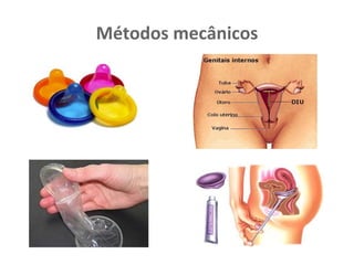 Métodos mecânicos
 