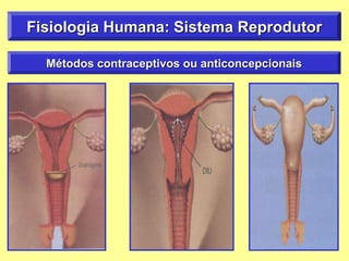 Fisiologia Humana: Sistema Reprodutor
Métodos contraceptivos ou anticoncepcionais
 
