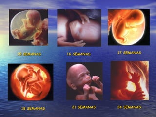 15 SEMANAS 18 SEMANAS 21 SEMANAS 17 SEMANAS 16 SEMANAS 24 SEMANAS 