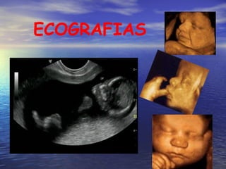 ECOGRAFIAS 