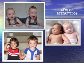 GÊMEOS DIZIGÓTICOS 