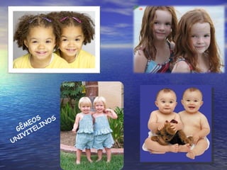 GÊMEOS  UNIVITELINOS 