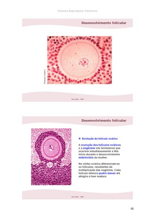 Sistema Reprodutor Feminino




                              10
 