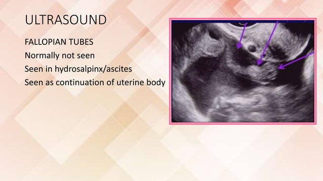 Imaging of female reproductive system RV | PPTX