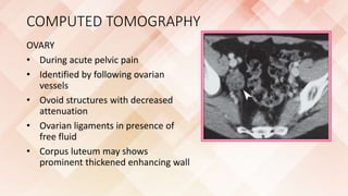 Ovoid Structures Imaging of female reproductive system RV | PPTX