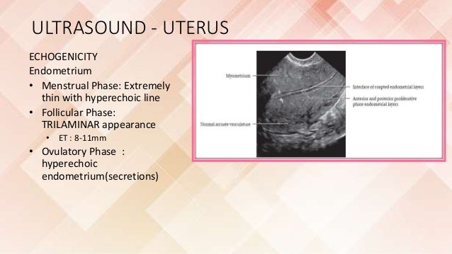 Imaging of female reproductive system RV