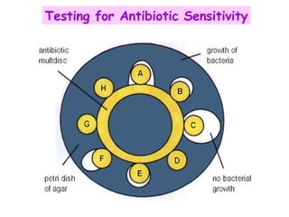 Testing for Antibiotic Sensitivity 