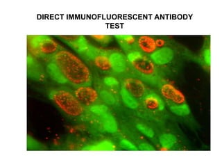 DIRECT IMMUNOFLUORESCENT ANTIBODY
TEST
 