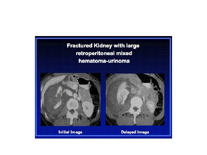 Reproteritoneum Anatomy and Pathology