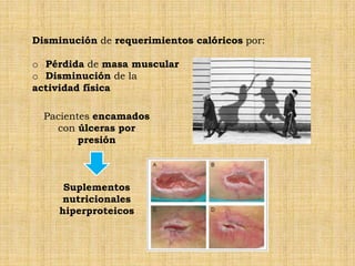 Disminución de requerimientos calóricos por:

o Pérdida de masa muscular
o Disminución de la
actividad física

  Pacientes encamados
    con úlceras por
         presión



      Suplementos
      nutricionales
     hiperproteicos
 