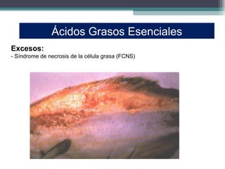 Ácidos Grasos Esenciales
Excesos:
- Síndrome de necrosis de la célula grasa (FCNS)
 