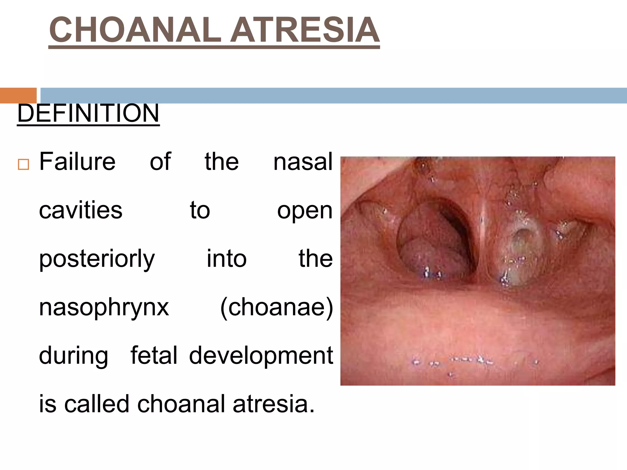 RESPIRATORY DISORDERS IN CHILDREN