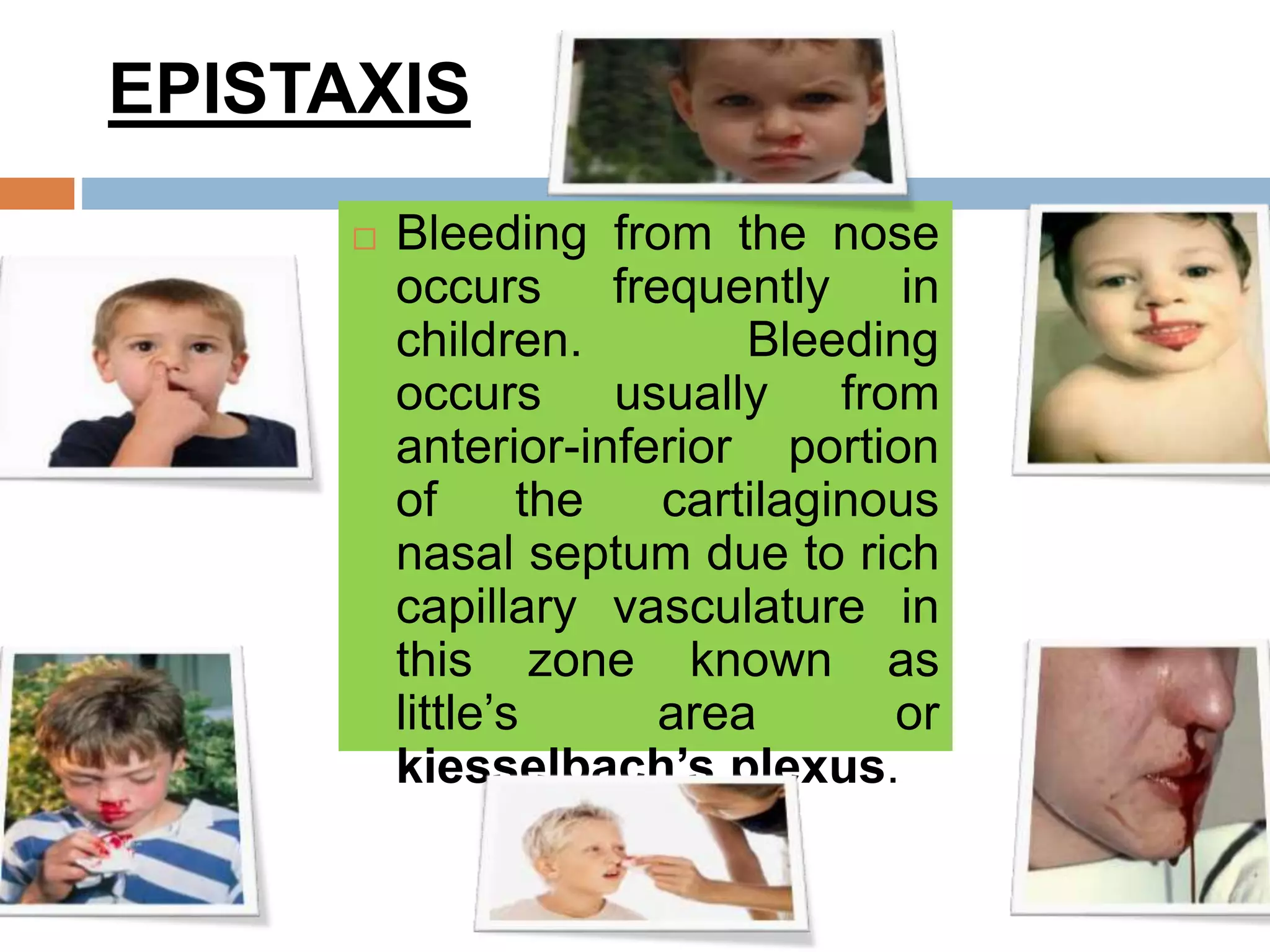 RESPIRATORY DISORDERS IN CHILDREN