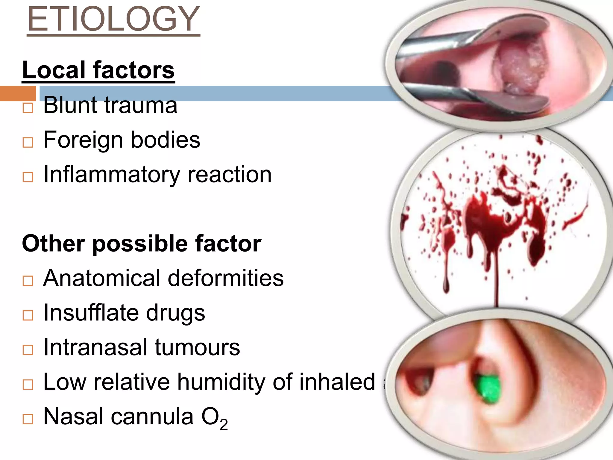 RESPIRATORY DISORDERS IN CHILDREN