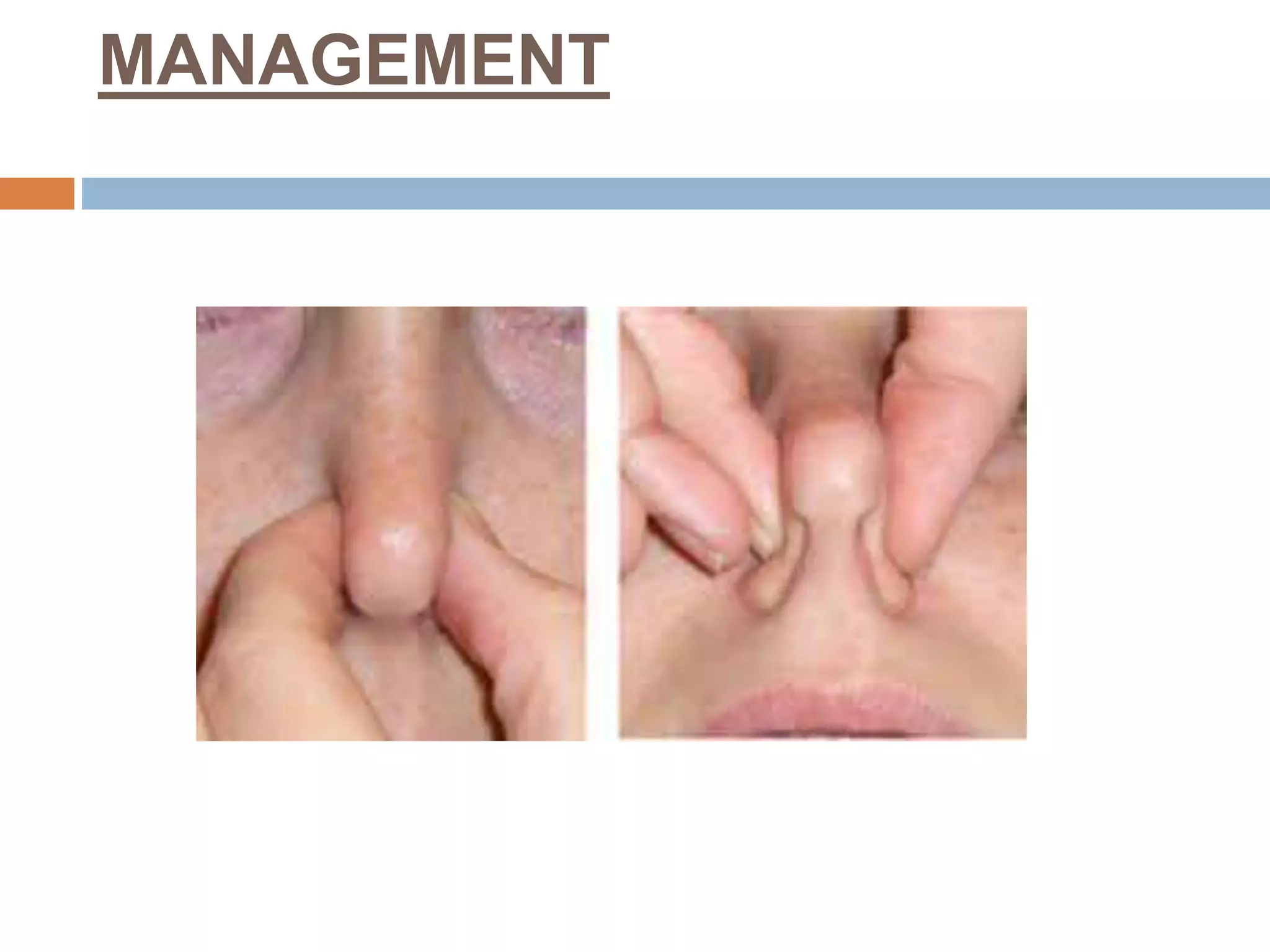 RESPIRATORY DISORDERS IN CHILDREN