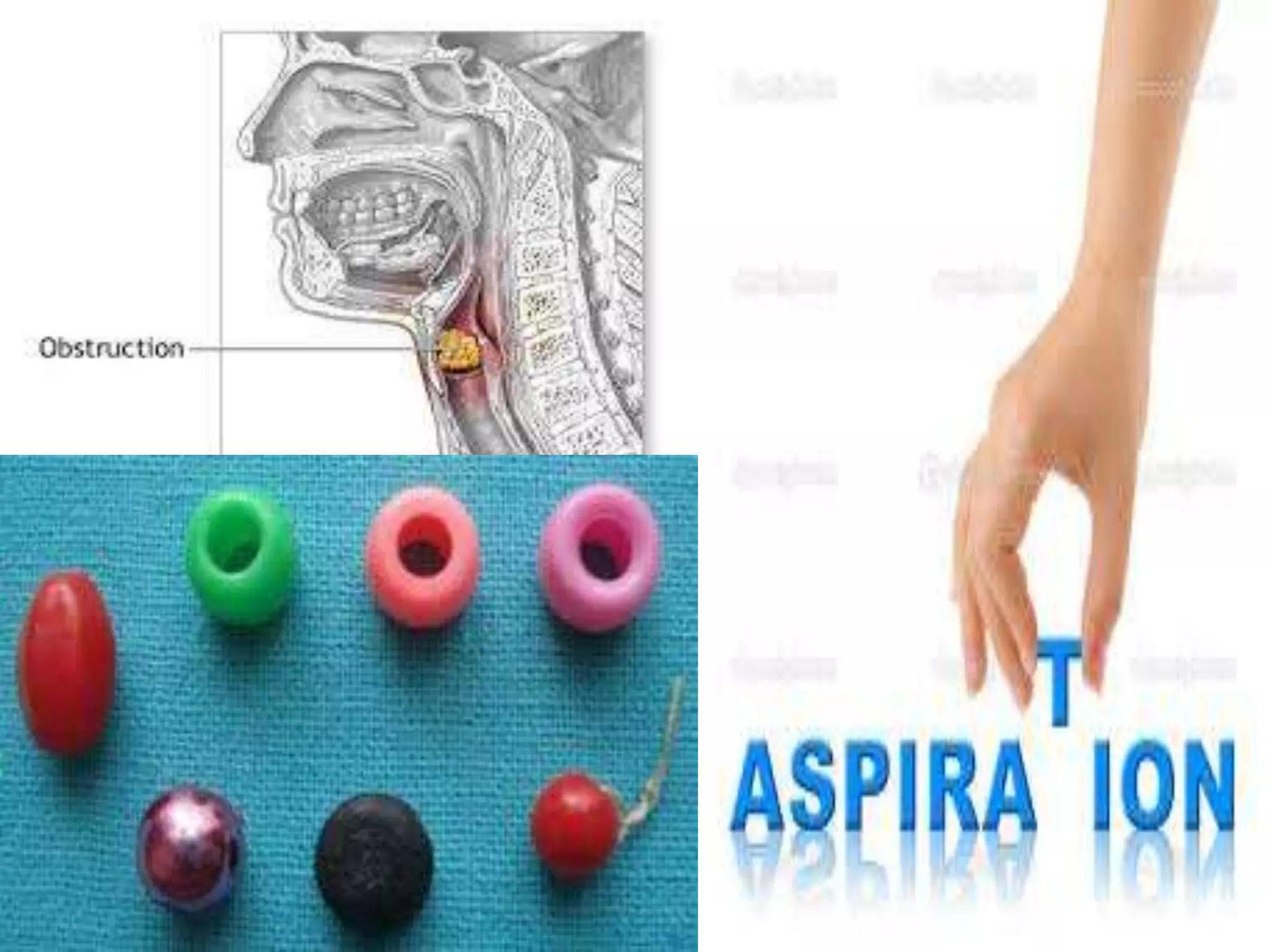 RESPIRATORY DISORDERS IN CHILDREN