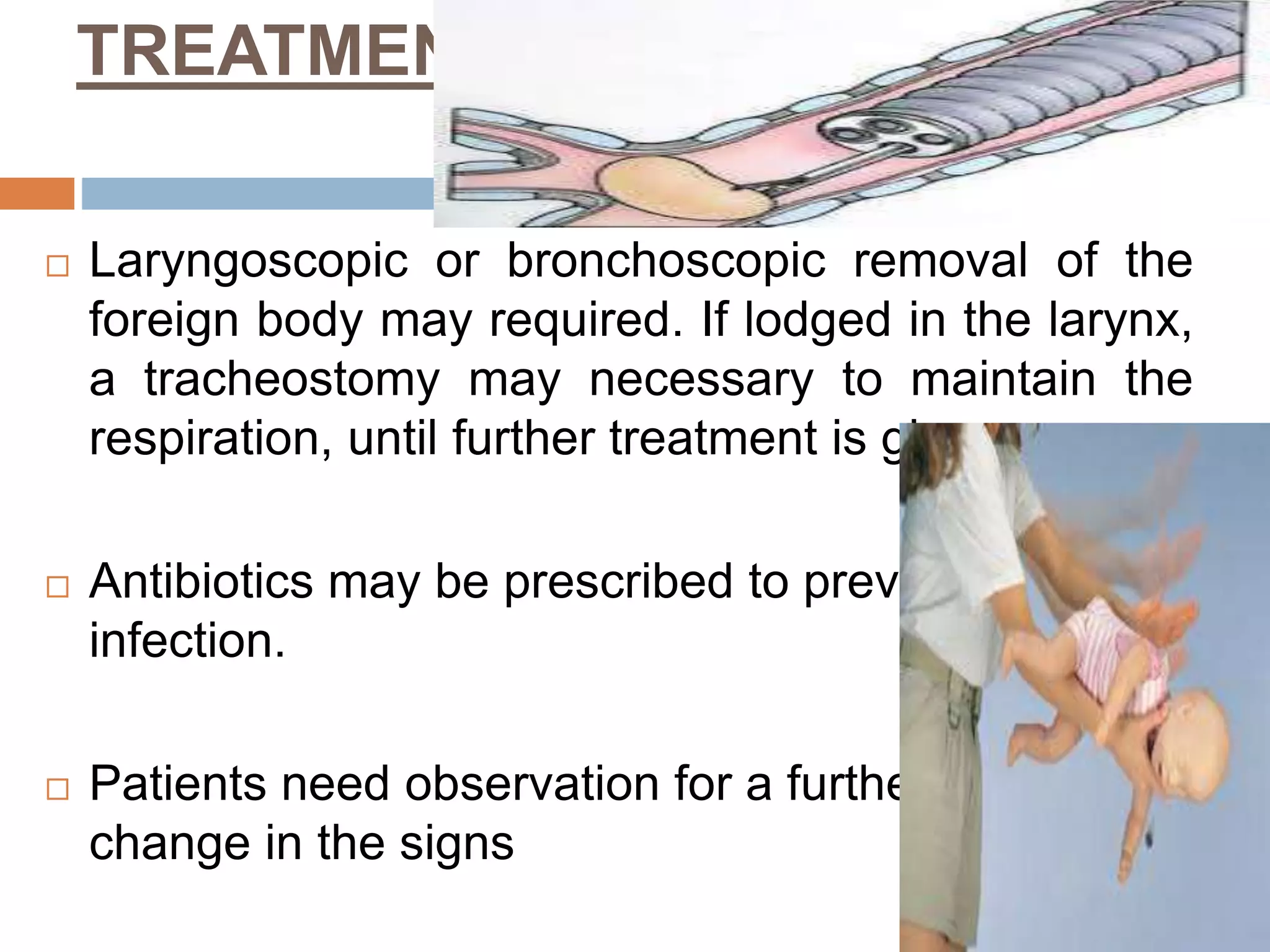 RESPIRATORY DISORDERS IN CHILDREN