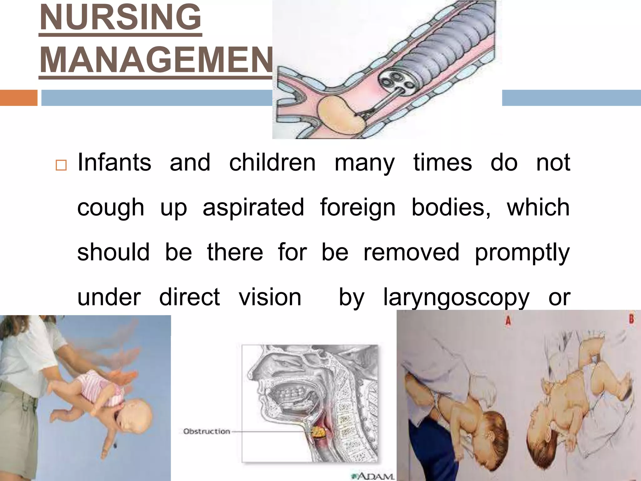 RESPIRATORY DISORDERS IN CHILDREN