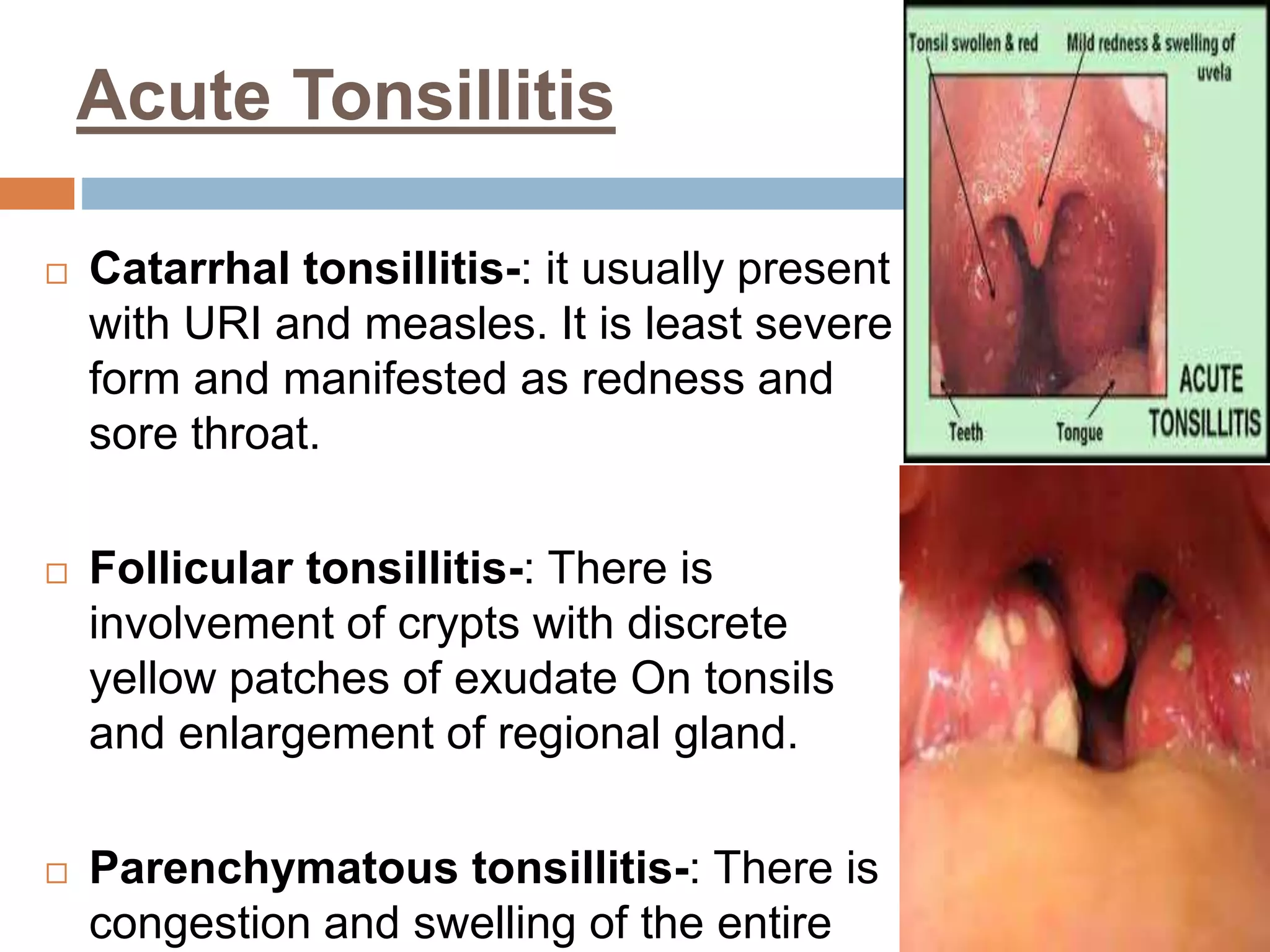 RESPIRATORY DISORDERS IN CHILDREN