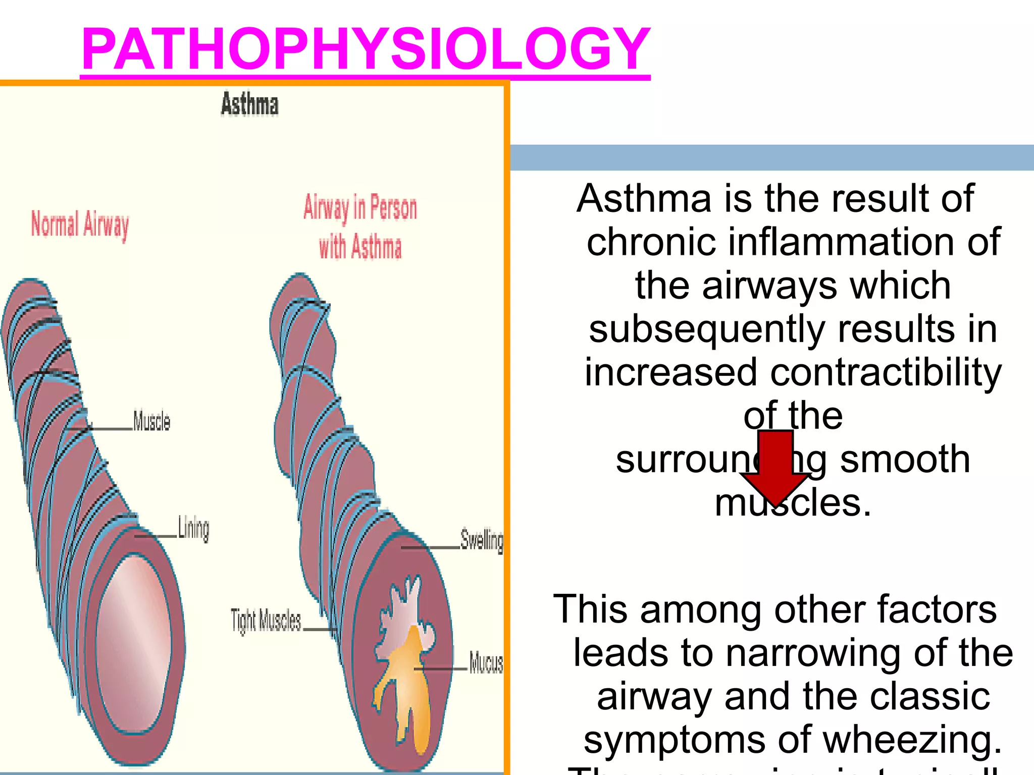 RESPIRATORY DISORDERS IN CHILDREN