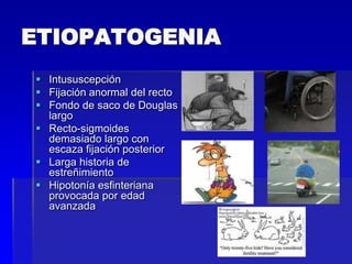 ETIOPATOGENIA
 Intususcepción
 Fijación anormal del recto
 Fondo de saco de Douglas
largo
 Recto-sigmoides
demasiado largo con
escaza fijación posterior
 Larga historia de
estreñimiento
 Hipotonía esfinteriana
provocada por edad
avanzada

 