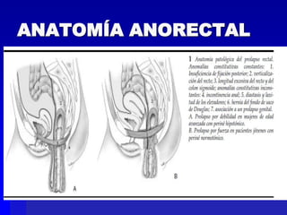 ANATOMÍA ANORECTAL

 
