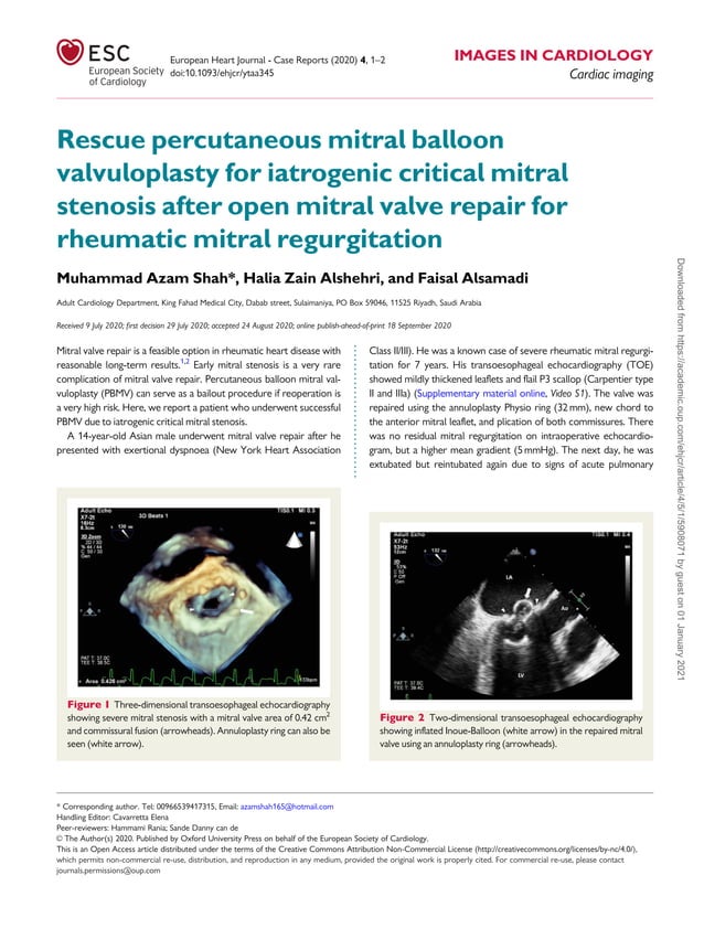 Rescue percutaneous mitral balloon valvuloplasty for iatrogenic ...