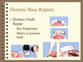 Denture Base Repairs
Denture Tooth
Repair
– Box Preparation
– Matrix to position
tooth
 