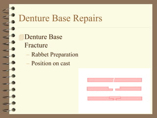 Denture Base Repairs
Denture Base
Fracture
– Rabbet Preparation
– Position on cast
 